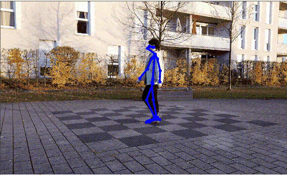 Robust Human Motion Forecasting using Transformer-based Model